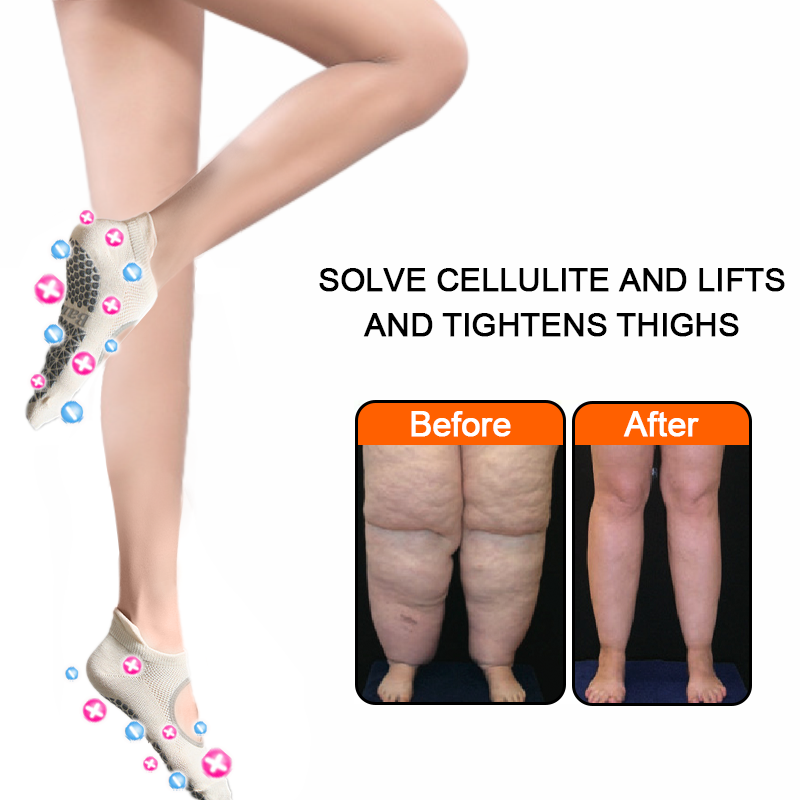 🎉🎉Baicloud™ PulseGrid Turmalin-Ionensocken (zeitlich begrenztes Angebot, hält 30 Minuten) 