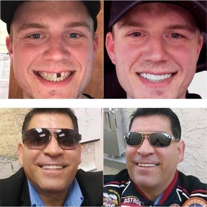 💝Letzter Tag Rabatt – 60 % Rabatt💝Neueste👨‍⚕Verstellbare Snap-On-Zahnprothesen😁